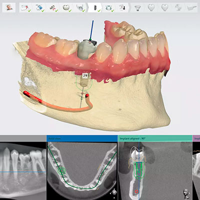 3D-сканер в стоматологии