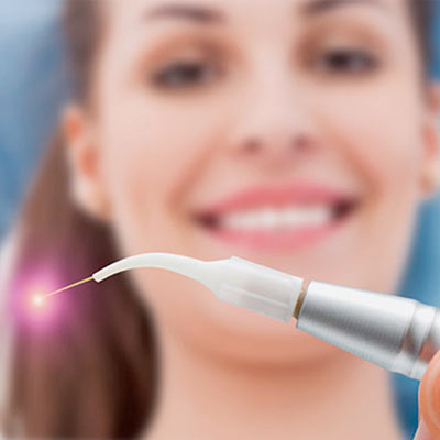 Лечение зубов диодным лазером PICASSO